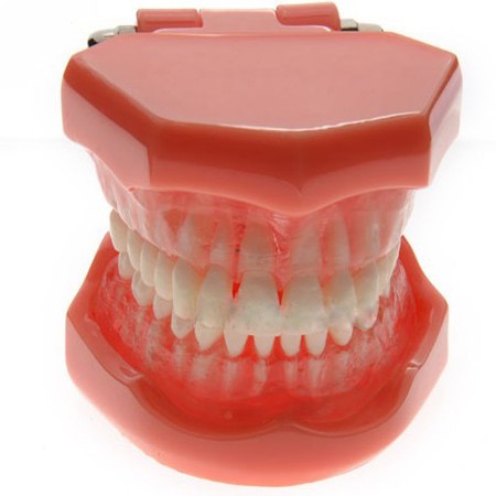 YZDKJDZ Modèle De Dents, Modèle De Dent Orale Orthodontique avec 32 Dents  Amovibles, Modèle De Gencive Molle pour Typodont, pour Démonstration De